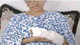 تازة : 15 سنة سجنا نافذا على متهم شوه وجه طليقته بآلة حادة ..