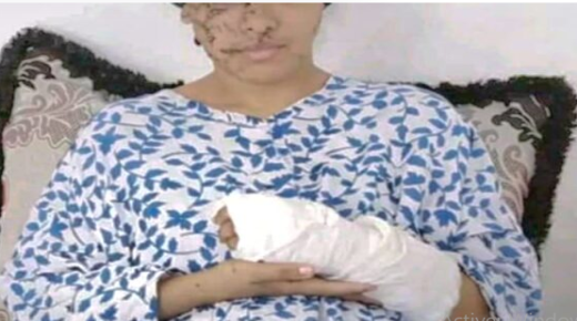 تازة : 15 سنة سجنا نافذا على متهم شوه وجه طليقته بآلة حادة ..